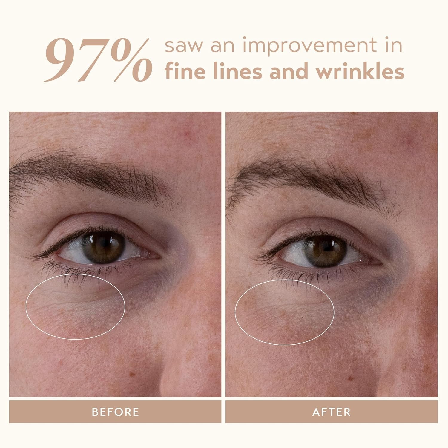 SKIN CARE Retinol Reform Anti-Aging Serum, Resurfacing Retinol Serum for Face and Neck, Helps with Fine Lines and Wrinkles, 1.01 Fl Oz