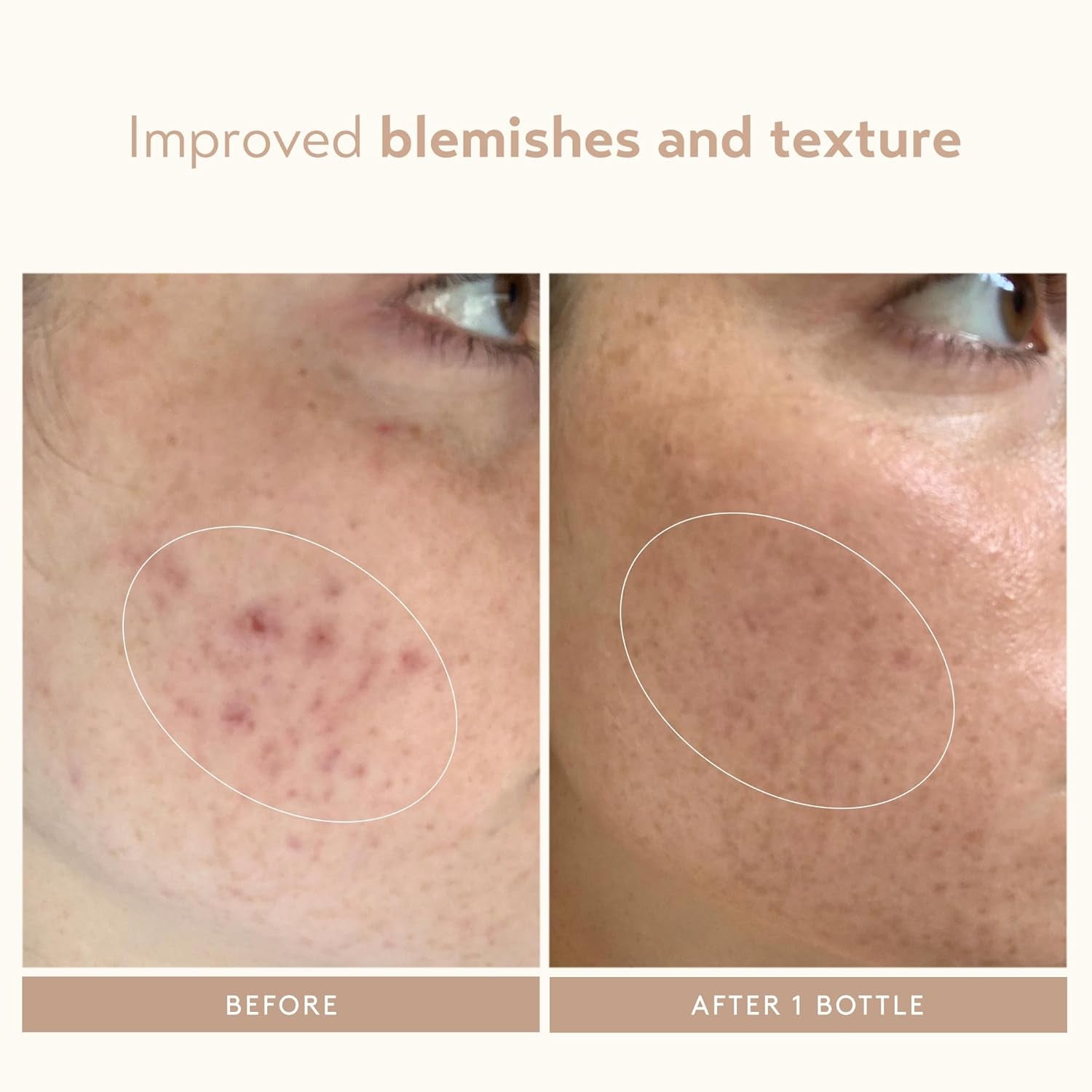 SKIN CARE Retinol Reform Anti-Aging Serum, Resurfacing Retinol Serum for Face and Neck, Helps with Fine Lines and Wrinkles, 1.01 Fl Oz